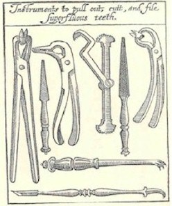 Aparelhos para a extração dental.