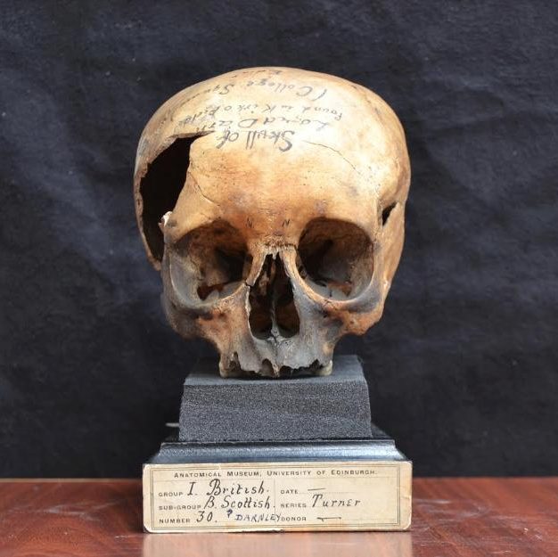 darnley4-large_trans++1DujuffDnVkYWS3aXLVehbd9uv0LEJtKrqF65QxITWk